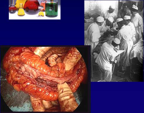 Cases: Sweet and Not So Sweet History The story of Crohn ( s) Surgery and Medicine for IBD When to operate