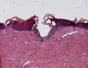 Vaginal mucosal histological preparations stained with haematoxylin and eosin (H&E).