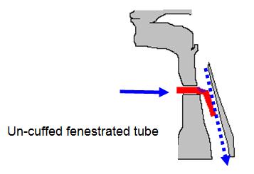 Fenestrated Tubes Fenestrated tubes have an opening(s) on the outer cannula, which allows air to pass through the patient's oral/nasal pharynx as well as the tracheal opening.
