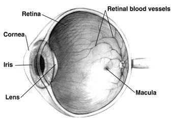 What is diabetic retinopathy? Blood vessels bring oxygen and nourishment to your retina. In diabetic retinopathy the blood vessels at the back of your eye may be damaged in a number of ways.