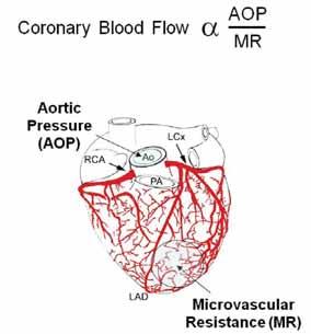 Figure 12. Coronary blood flow is proportional to the ratio of the AOP and the MR. Figure 13.