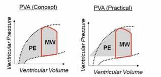 34-37 As discussed previously, maximum wall tension is related to the EDP and EDV through the Law of LaPlace, and reductions in these parameters lead to reduced microvascular resistance and increased