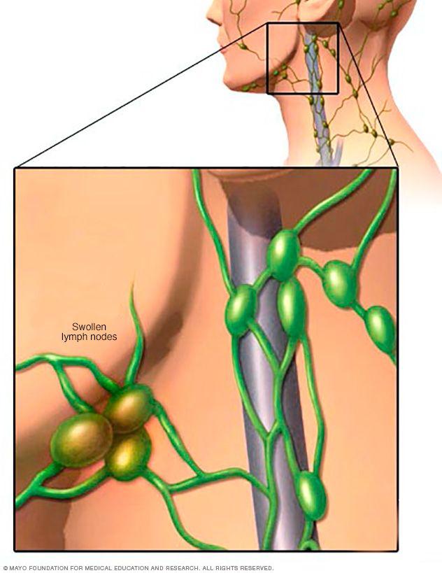 Anatomy Lymph nodes: Encapsulated structures that are round, oval, or bean shaped.