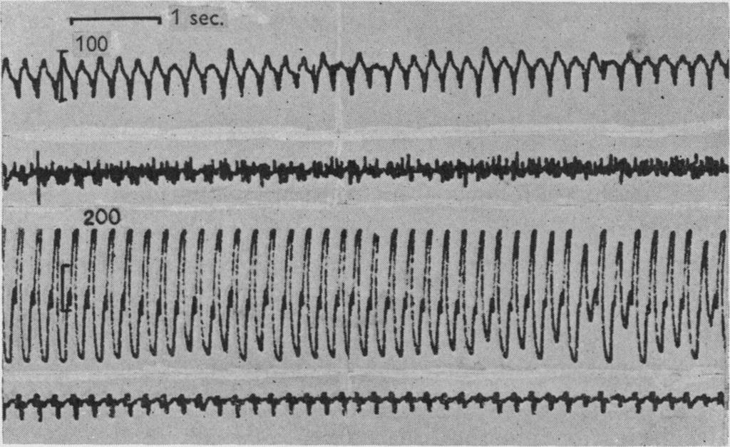 SPINAL ACTIONS OF DIRECT CURRENTS 319 the changes described above are the electrical correlates of Scheminzky's phenomenon.