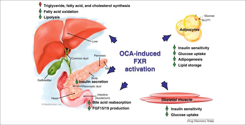 Obeticholic Acid OCA: Semi-synthetic bile acid FXR agonist Insulin sensitizer