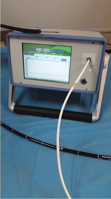 2 BioMed Research International P 1 d H a b P 2 c Endoscope Figure 1: Noninvasive measurement of variceal pressure using the endoscopic fibre-optic pressure sensor inserted through the working