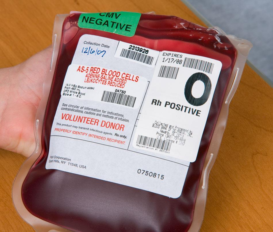 Blood Transfusion Blood component therapy = IV administration of whole blood or blood component Blood