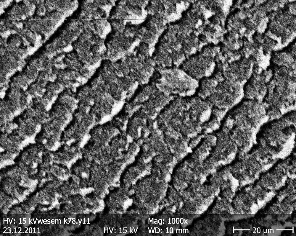 Fig.7a-4-Broken lens fibres in the equatorial region