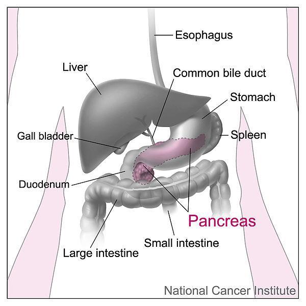 NEUROENDOCRINE TUMOURS: SYMPTOMS Symptoms: Pain Nausea Change in bowel habits Lung chest infections, shortness of breath, cough, haemoptysis