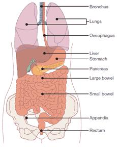 NEUROENDOCRINE TUMOURS Neuroendocrine tumour (NET) = tumour of the neuroendocrine system Most common locations are in the lungs and digestive system Carcinoid when tumours arise in the tubular