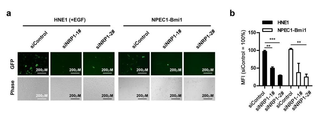 Supplementary Figure 9. Knockdown of NRP1 inhibits EBV infection of EGF-treated HNE1 and NPEC1-Bmi1 cells.