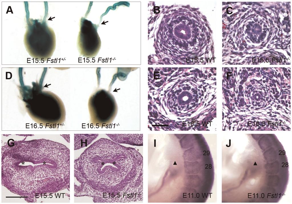 Fstl1 Regulates Ureter Development Figure 3. Defects of UV orifice and distal ureter in Fstl1-/- embryo. (A-F) Fstl1+/- mice were crossed to Ptch-lacZ +/- mice.