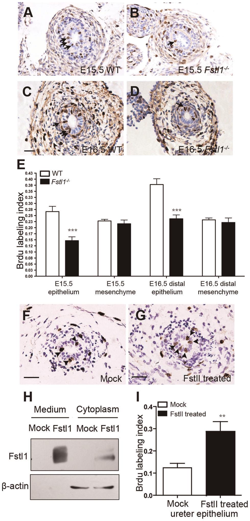 Figure 4. Proliferation defects in Fstl1 -/- ureteric epithelial cells.