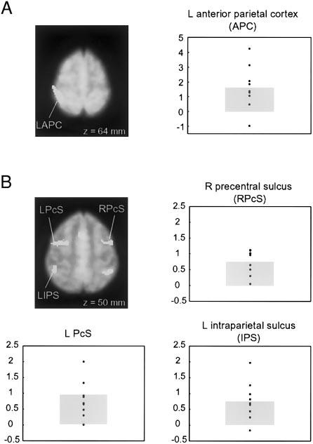 FUNCTIONAL NEUROANATOMY OF MOTOR IMAGERY 995 FIG. 4. Activity associated with accuracy of task performance.
