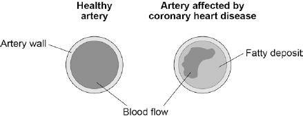 (d) The coronary arteries supply blood to the heart. Figure 2 shows two coronary arteries.