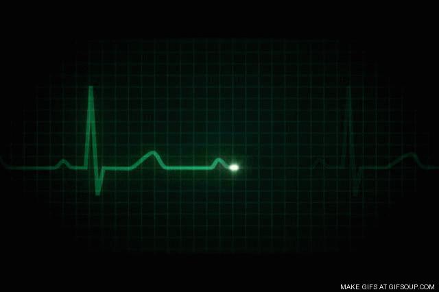 Electrocardiogram (ECG or EKG) An electrocardiogram records the electrical signals in your heart.