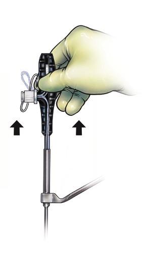 (Figure 9a) lightly pull back on the anchor inserter handle to set the