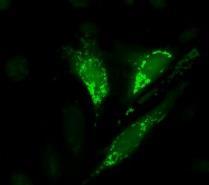 % of Mitophagic cells 1 8 6 4 2 66 HHr