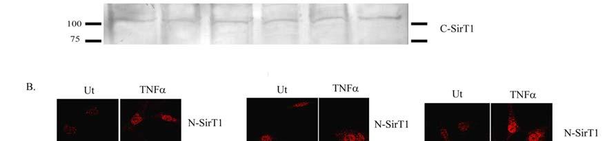 above the blots), were immunoblotted with N-terminally reactive SirT1 (N-SirT1) antibody.