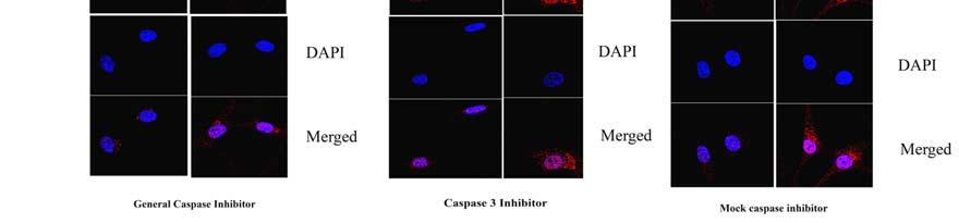 Confocal images of OA hch treated with general caspase inhibitor (left panel); caspase 3 inhibitor (middle