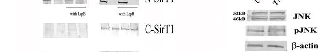 SD-4 SD-4: 75SirT1 is exported to the cytoplasm in a MAPK p38, CRM1- dependant fashion, following TNF -treatment. A.