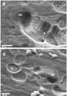 Human Osteoclasts CON ODN-treated Effects of reducing activity of CatK in the osteoclast Same or increased number of osteoclasts Shallow resorption pits Leung et al.