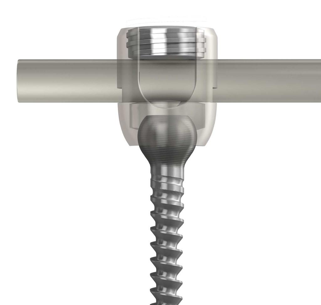 Screw housing and the Vane set Screw, and allows stability of the spinal fixation system in