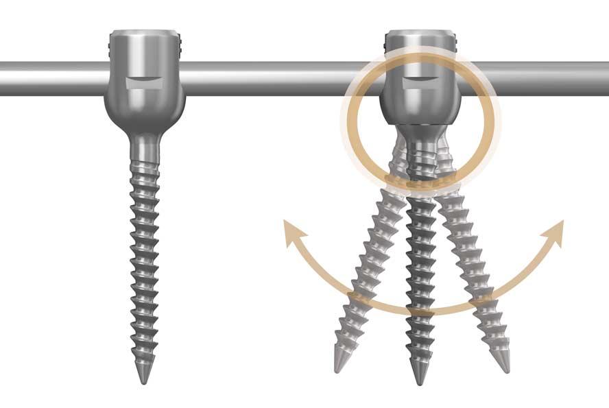 Vane Pedicle Screw System Mechanical Testing The mechanical test including static and cyclic fatigue test was