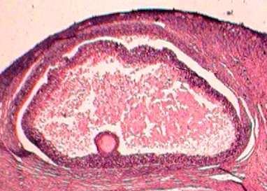 Ovarian follicles of Black Bengal goat types of follicles were compared during winter and summer season (Table 2).