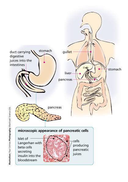 The pancreas In people with diabetes, the pancreas does not produce