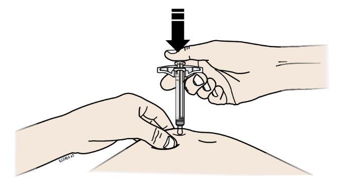 Important: Keep skin pinched while injecting.