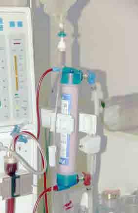 Haemodialysis Haemodialysis will need to become part of your routine. When you are off dialysis you can continue your normal daily life.