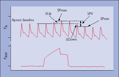 Arterial Systolic Pressure Variation