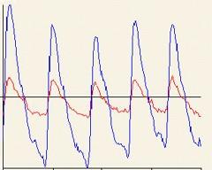 Detected RED & IR signal waveforms Sampling profile