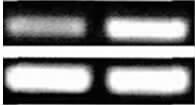 . caspase-3 258 bp GAPDH M r 1.7 10 4 GAPDH 534 bp caspase-3 M r 3.6 10 4 4 RT-PCR caspase-3 mrna Figure 4 Expression of caspase-3 mrna in human liver cancer stem cells detected by RT-PCR 2.