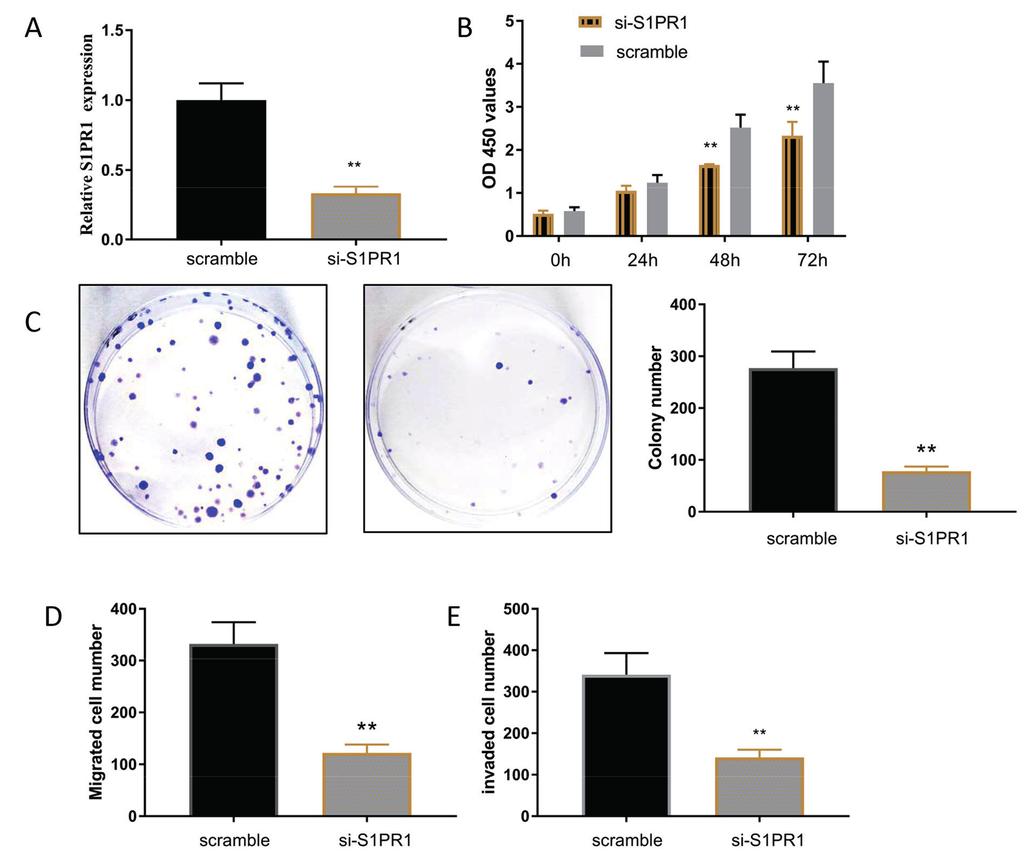 mir-542-3p regulates breast cancer cells invasion Figure 5. Downregulation of SIPR1 reduces tumorigenesis. (A) Validation of SIPR1 expression levels after transfection by western blot.