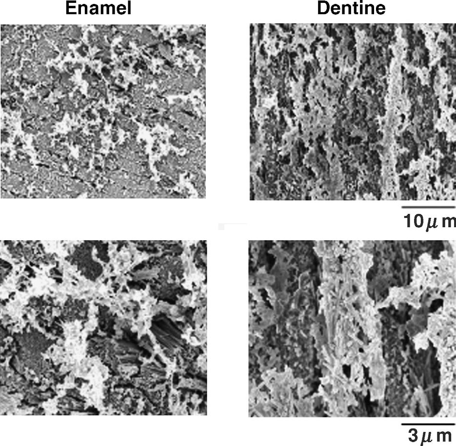 10 K. Fujita, N. Nishiyama Figure 8 Effects of ethanol rinsing on the enamel and dentine surfaces, condition by the Mega Bond Primer. Upper photograph (3000!).