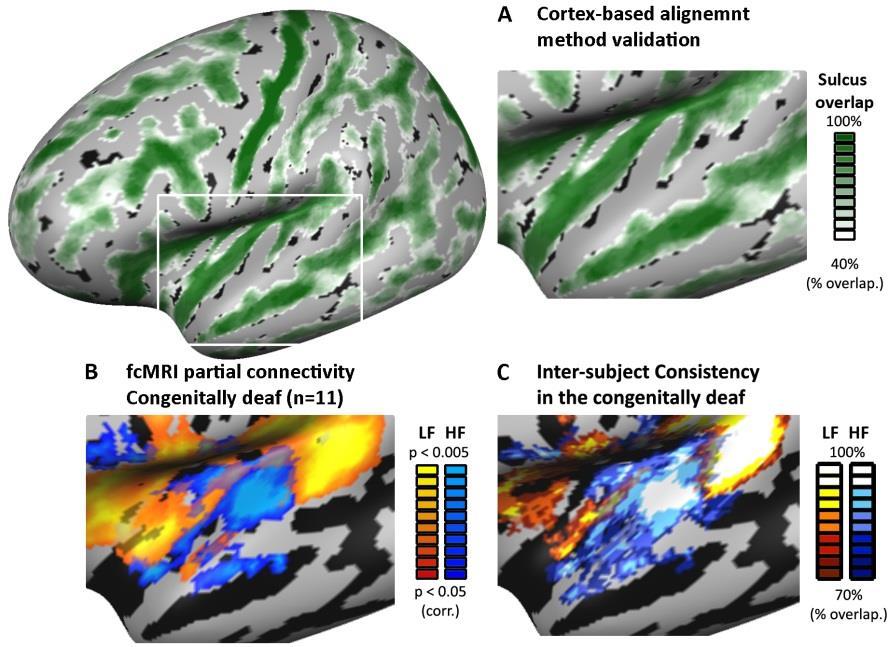 Figure S3: Cortex-based alignment fcmri confirms topographic patterns in the deaf A. The cortical surface depicts the result of the surface-based alignment.
