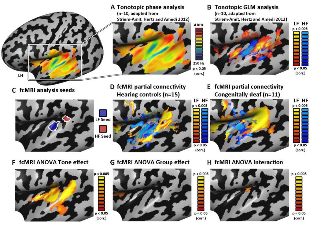 Figure S5: Cortex-based alignment fcmri smoothed at the surface level confirms topographic patterns in the deaf In a comparable manner to shown in Figure 1, the analyses were replicated using data