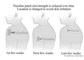 Nicotine Patch Wear for 16 hours and take off each night before sleeping Nicotine Gum 2 mg = < 25 cigarettes/day 4 mg = > 25 cigarettes/day Weeks