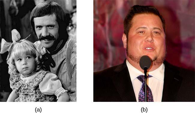 FIGURE 10.19 Chaz Bono, a transgender male, is a well-known person who transitioned from female to male.