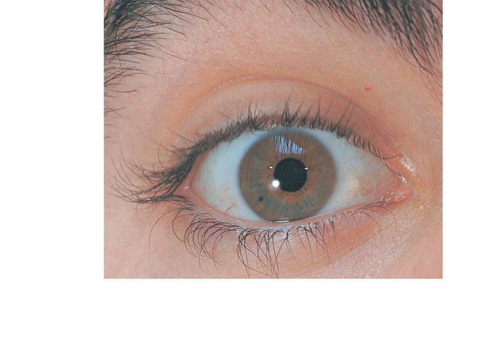 Eyebrow Eyelid Eyelashes Site where conjunctiva merges with cornea Palpebral fissure