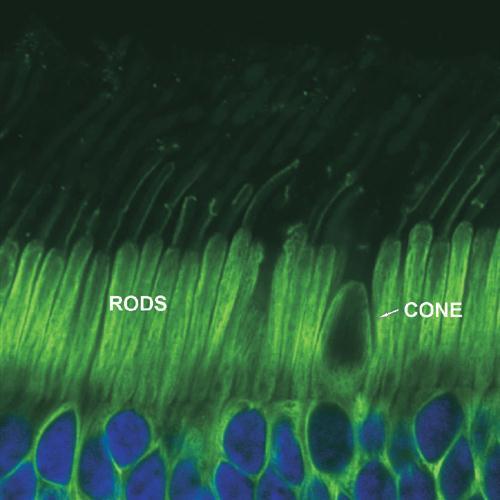 THE EYEBALL Photoreceptors Rods More numerous at peripheral region Dim