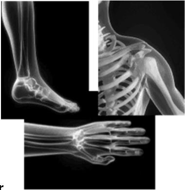 tendinopathy (1); Achilles tendinopathy (1); and acute rupture of the Achilles tendon (surgical repair) (1) Low quality evidence mostly due