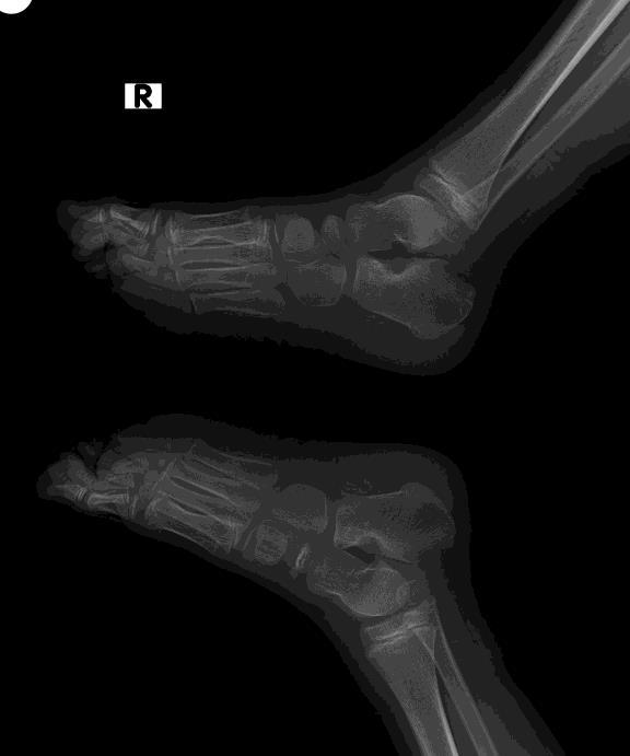 views of foot Image III-IV: