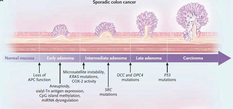 Colorectal Carcinogenesis: Genetic Model
