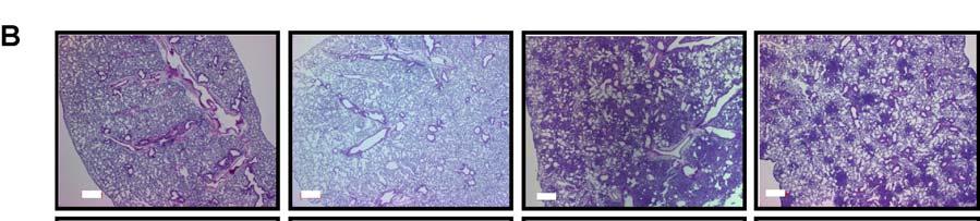 IFN-γ -/- CD4 + T cells