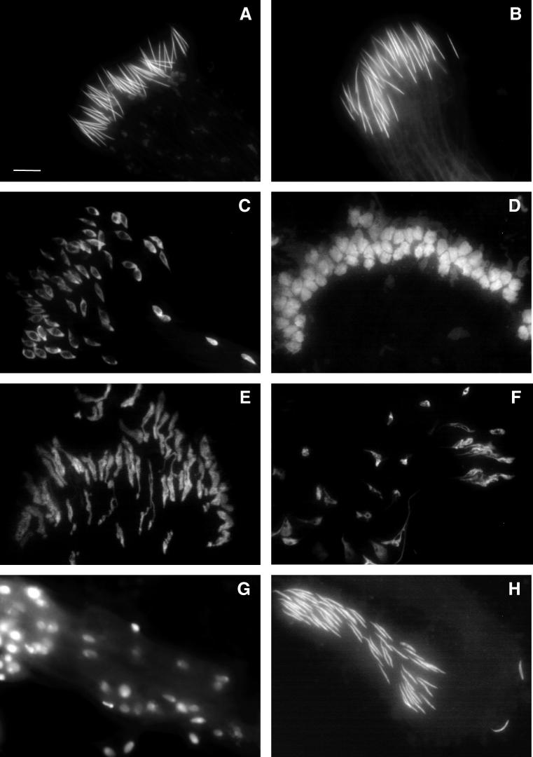 Male sterility and Y chromosome 2741 Fig. 5. Variability of sperm nuclei in cysts at their maximum elongation. (A,C,E,G) Delhi series; (B,D,F,H) Prunay series.