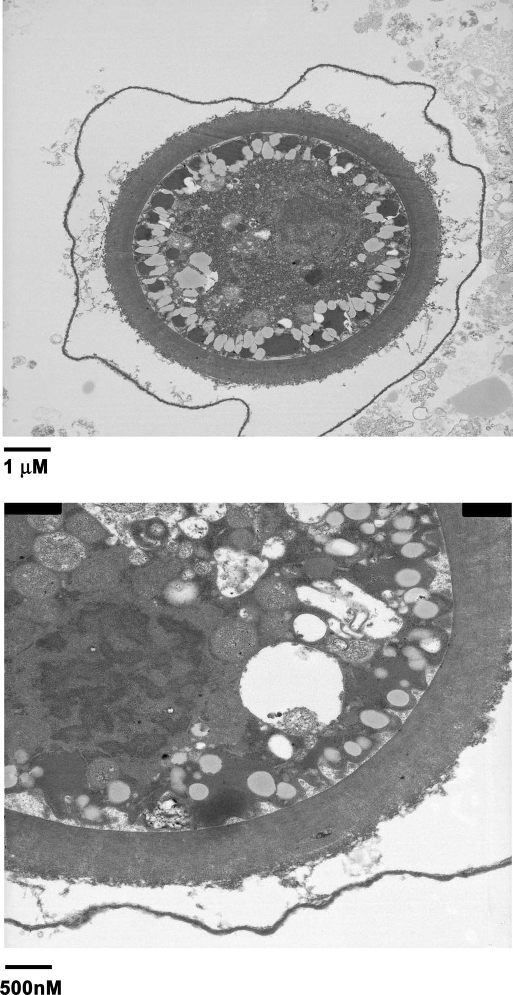 VOL. 21, 2008 INCREASING IMPORTANCE OF BALAMUTHIA MANDRILLARIS 439 FIG. 3. Transmission electron micrographs of a Balamuthia mandrillaris cyst.