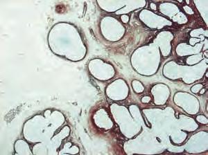13-29 to 31 Three histological slides showing